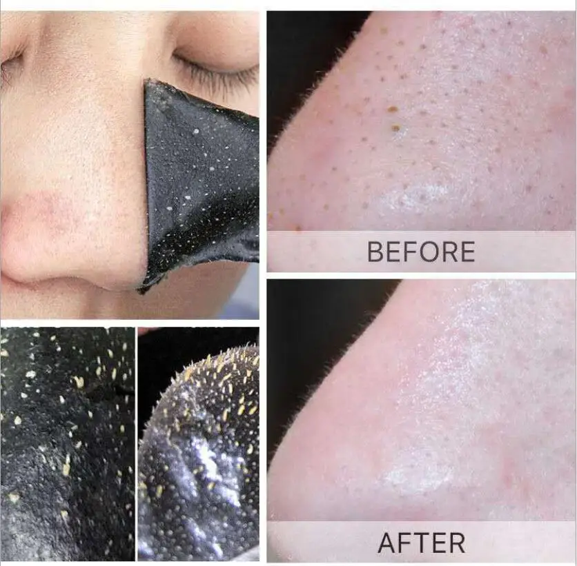 

100pcs Nose Blackhead Remover Mask Deep Cleansing Skin Care Shrink Pore Acne Treatment Mask Nose Black dots Pore Clean Strips