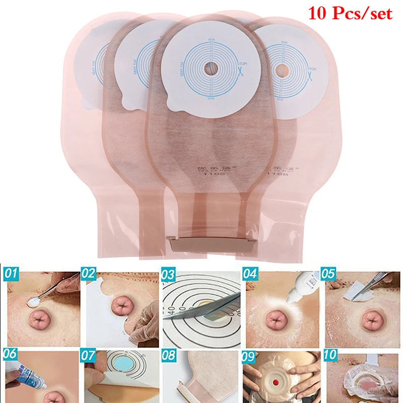 

10 шт. нетканых цельных мешков для остомии, предотвращающих утечку, клейкий слой для стомы, для максимальной резки 15-60 мм