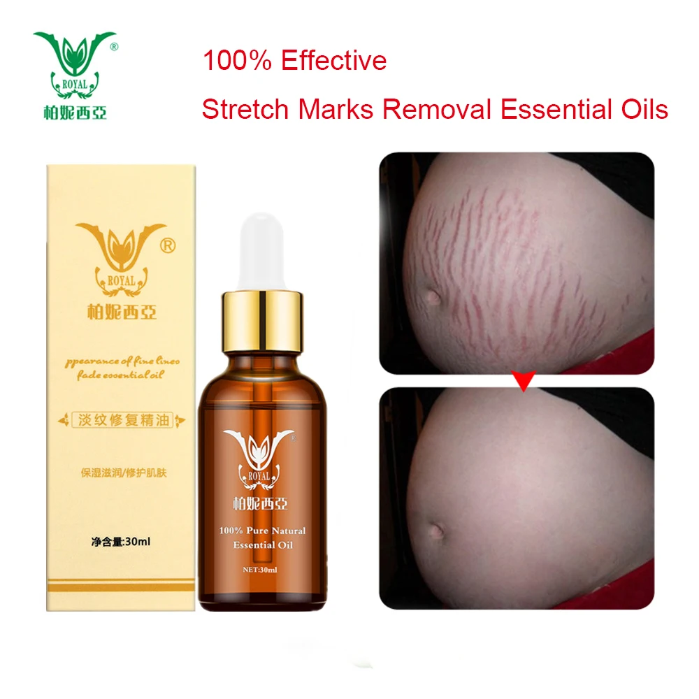 

Stretch Marks Removal Essential Oils Pure Natural Stretch Marks Remover Obesity Postpartum Anti-wrinkle Repair Cream Skin Care