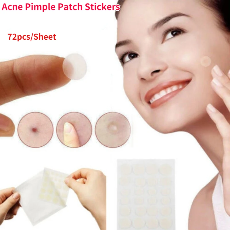 

72Pcs Acne Pimple Patch Stickers Acne Mole Remover Artificial Skin Skintag Patch Facial Health and Beauty Skin Care Tools Face