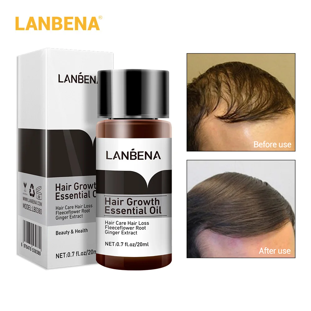 Эссенция для роста волос LANBENA уход за волосами мужчин и женщин эфирное масло