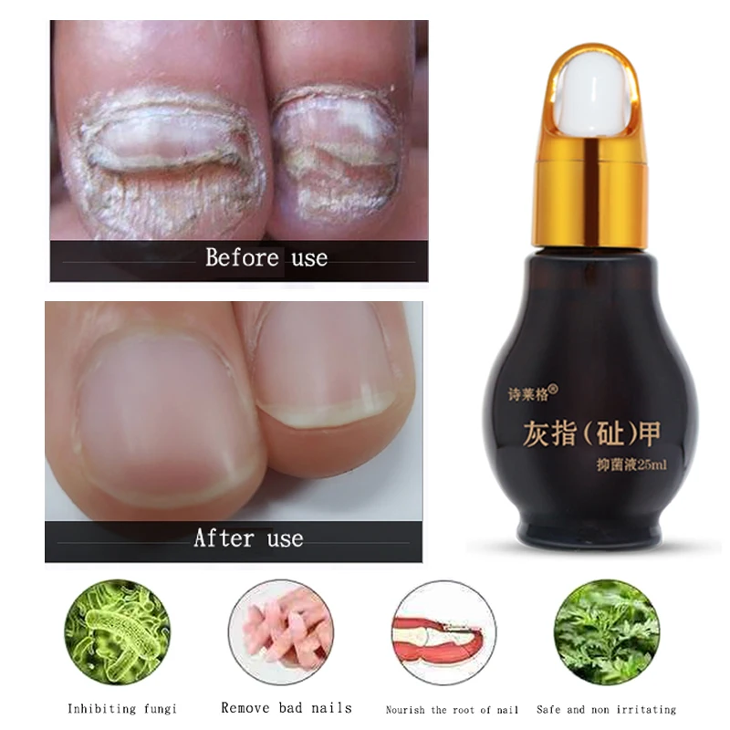 Сыворотка для восстановления ногтей 25 мл|Процедуры по дезинфекции кожи| |