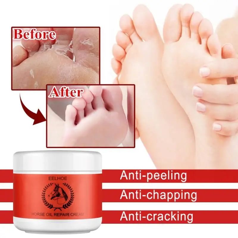 На основе конского жира крем для пяток ремонта против трещин отбеливающий ног