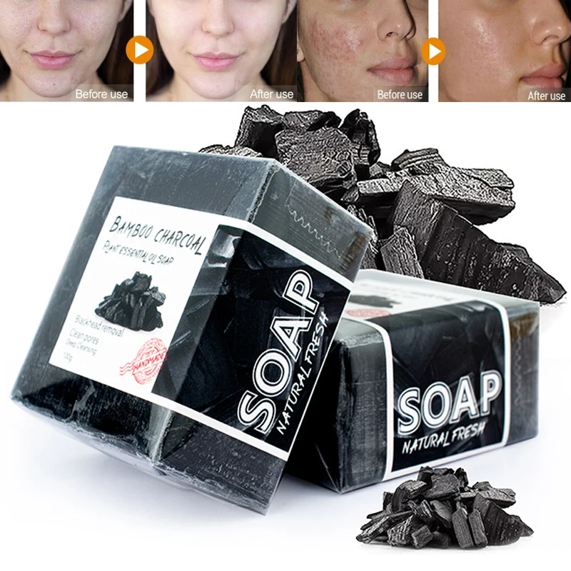 

Activated Charcoal Rose Handmade Soap Face Cleansing Whitening Soap Remove Acne Treatment Blackhead Oil Control Skin Care