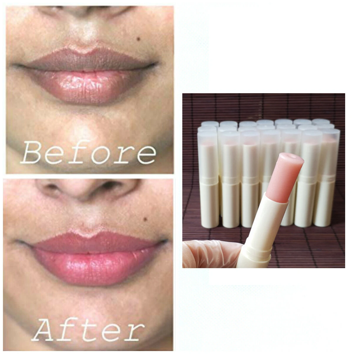 

Pink Fresh Lightening Lip Cream Treatment to Remove Dark Lips