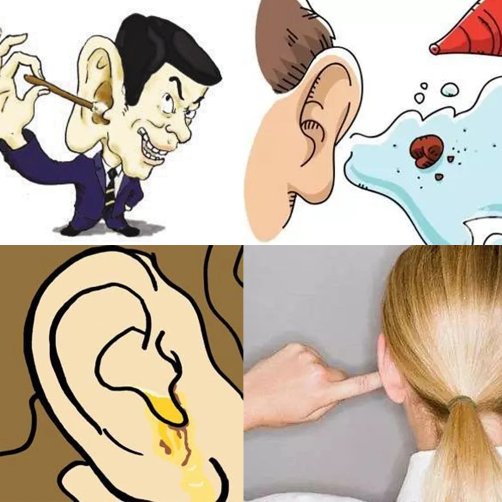 10 г/шт. средство для чистки ушей в ушах топическое очищающее антиприуритическое