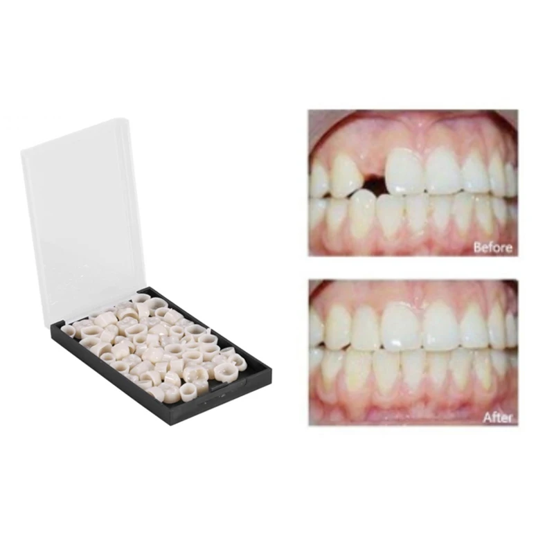 Стоматологические короны 50 шт./коркор. фарфоровые материалы из смолы временная