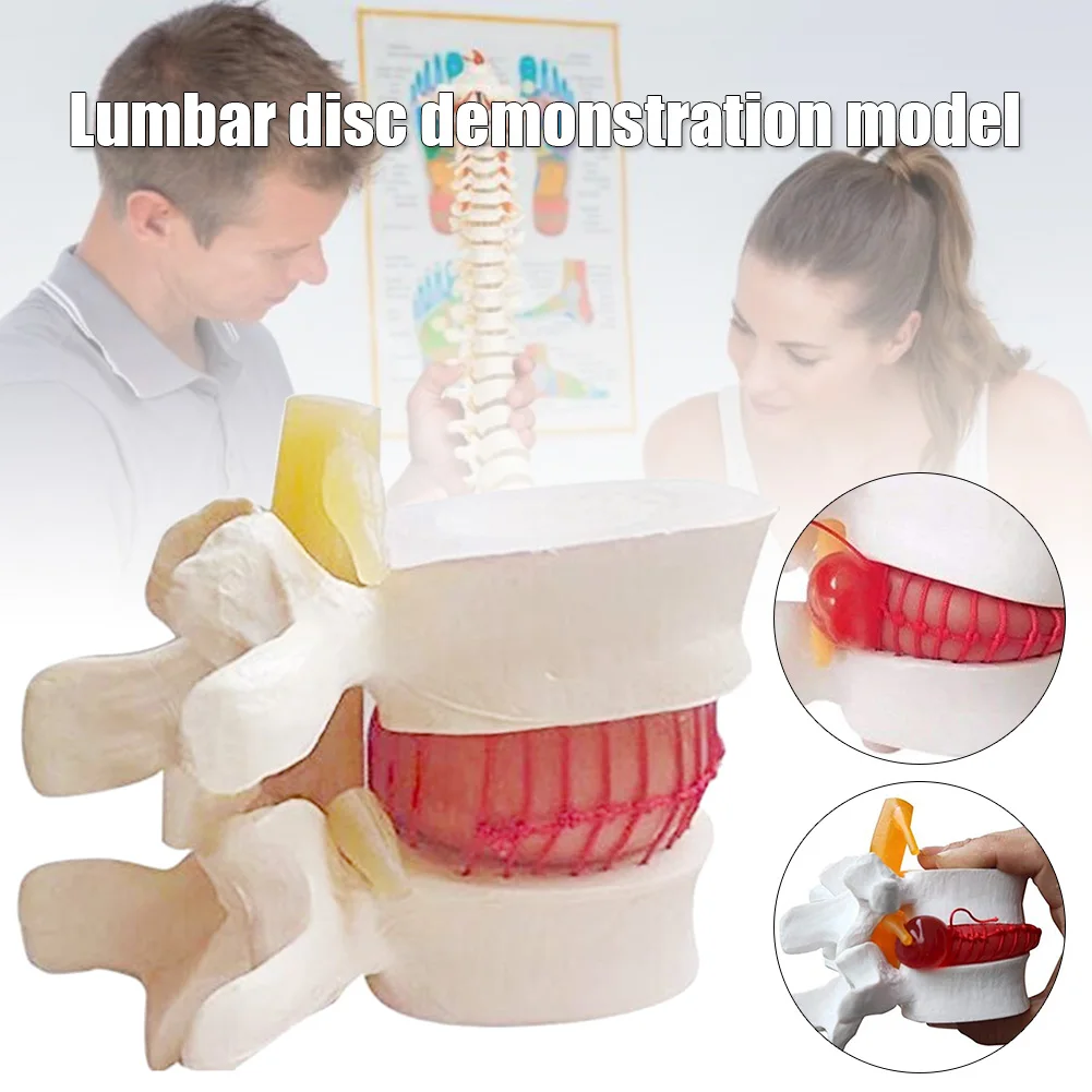 

1pc Anatomical Lumbar Disc Herniation Lumbar Spine Model White Color HFing
