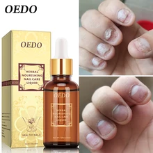 Fungal Nail Treatment Essential oil Hand and Foot Whitening Toe Nail Fungus Removal Infection Feet Care Polish Nail Gel