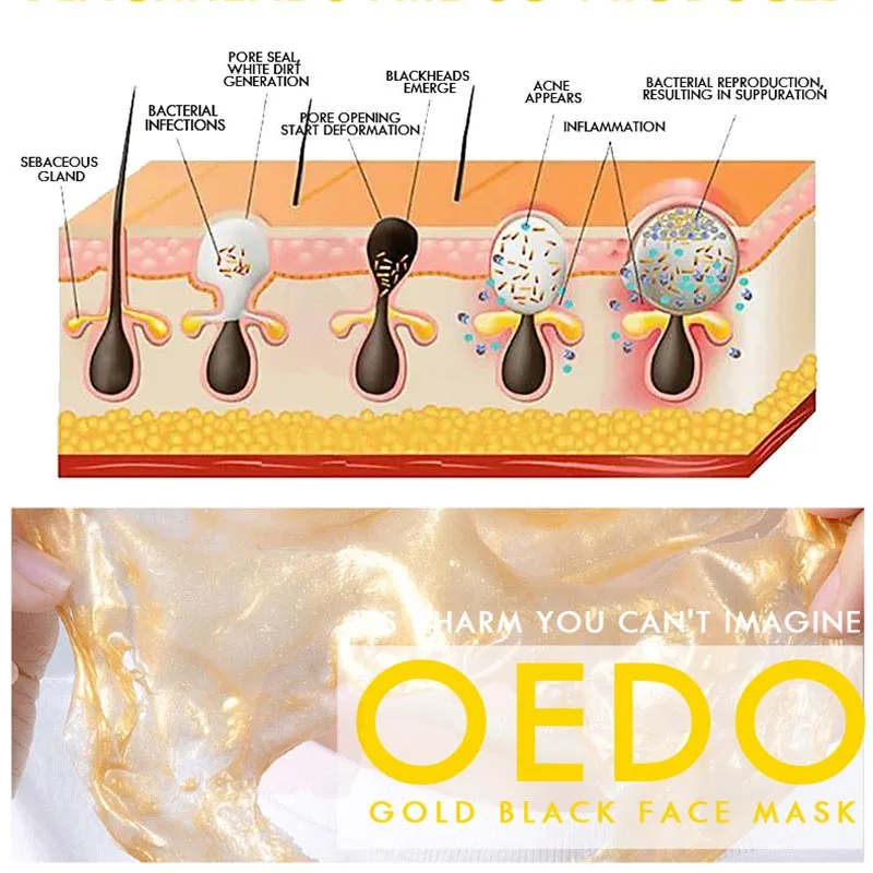 Лучшая увлажняющая маска для лица очищающая от черных точек питательная ухода за