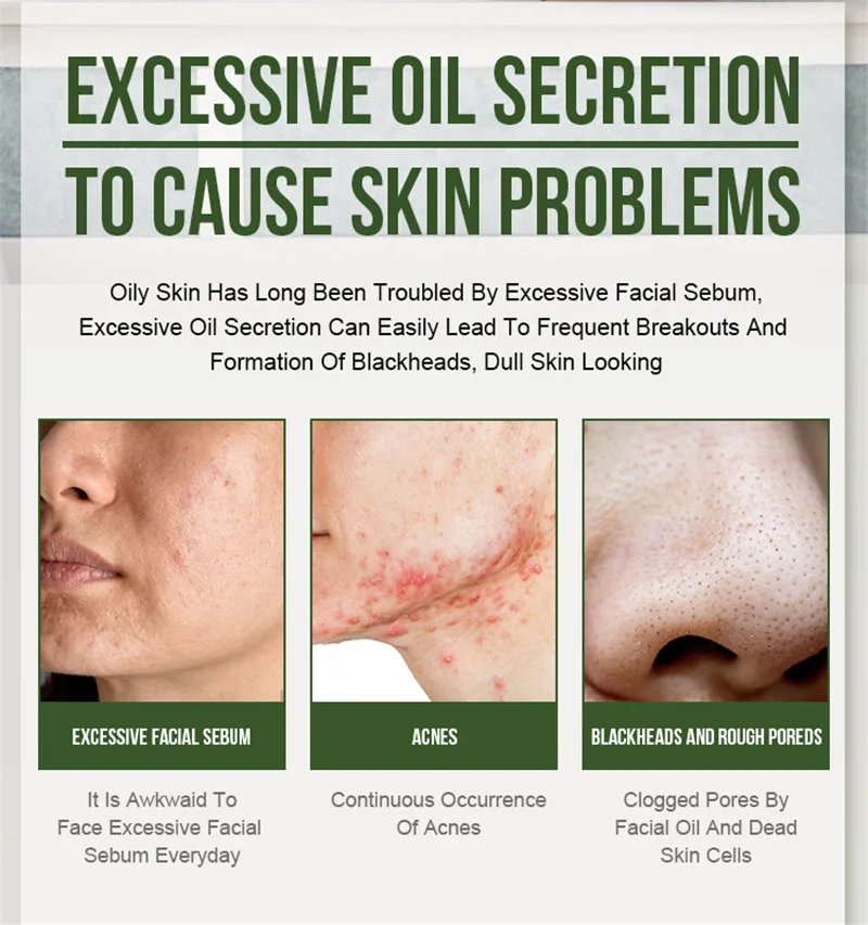 Эссенция чайного дерева восстанавливающий крем от акне отшелушивающий