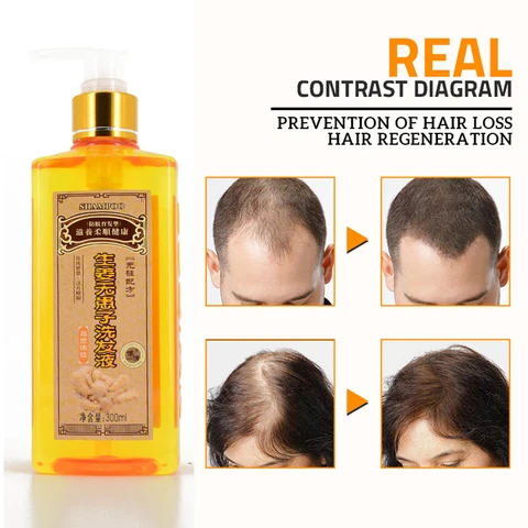 Оригинальный профессиональный шампунь для волос с имбирем 300 мл, быстрый восстановление плотности волос, утолщенный шампунь против выпадения волос