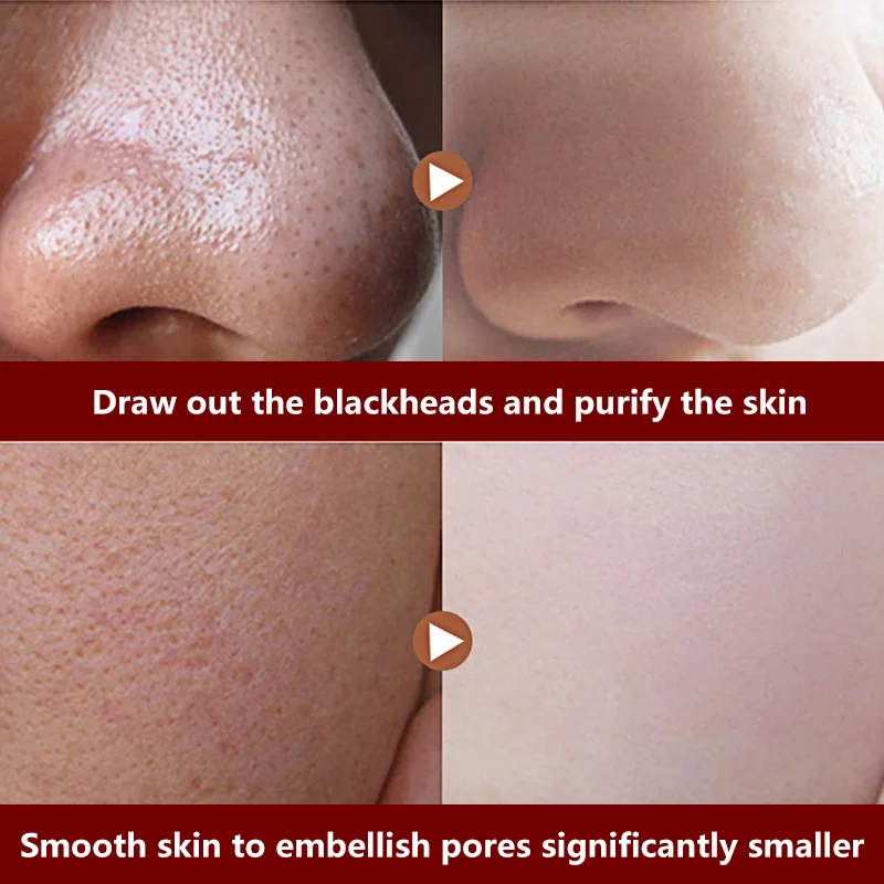 Медовая маска для удаления черных точек очистки масла Очищающий Отшелушивающий