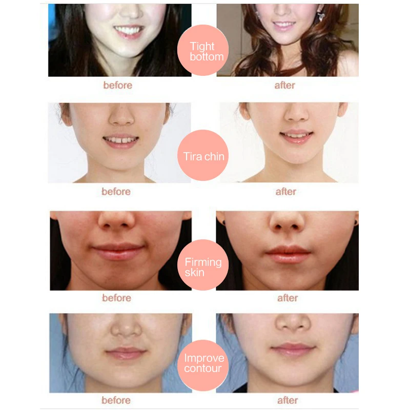 

V Face Mask Face Care Tool Eliminate Double Chin Edema Lifting Firming Face Line Slimming Mask V Shape Lift Patch Wrinkle Reduce