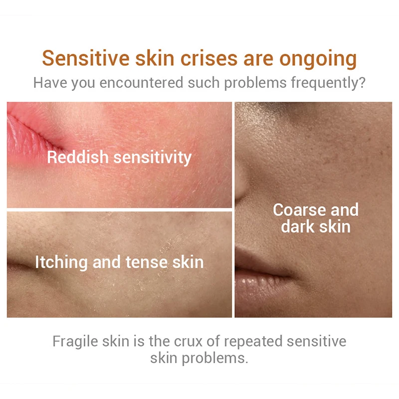 

LANBENA Ectoin Soothing Cream 50ml Collenage Sensitive Skin Repair Acne Treatment Anti Wrinkle Fine Lines Face Lotion TSLM1