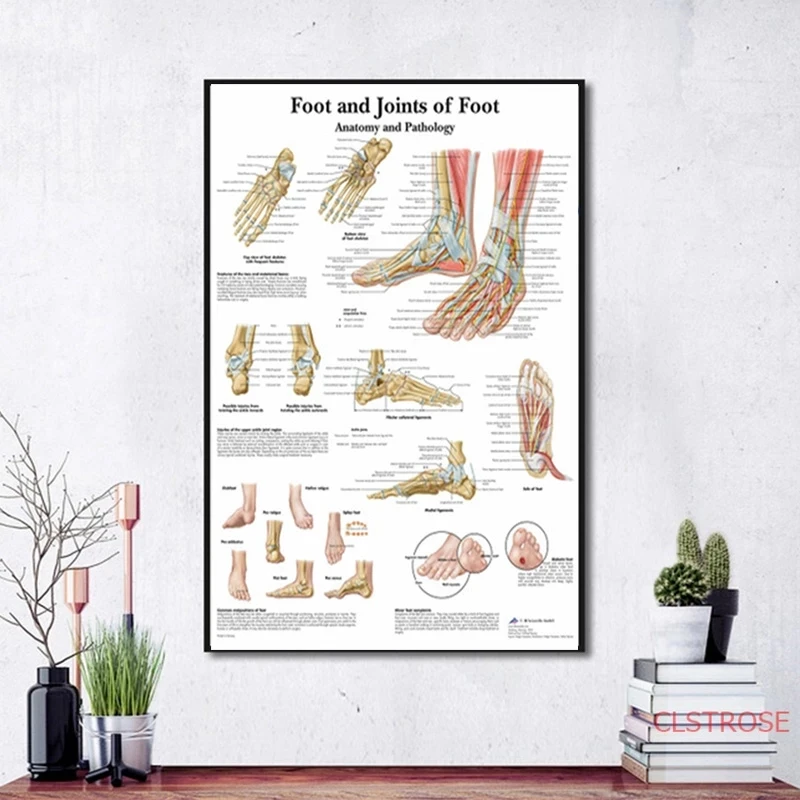 Картина на холсте с изображением акупунктуры