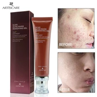 1pcs30g scar ointment repair gel ointment facial care makeup smooth the irregularity skin care products