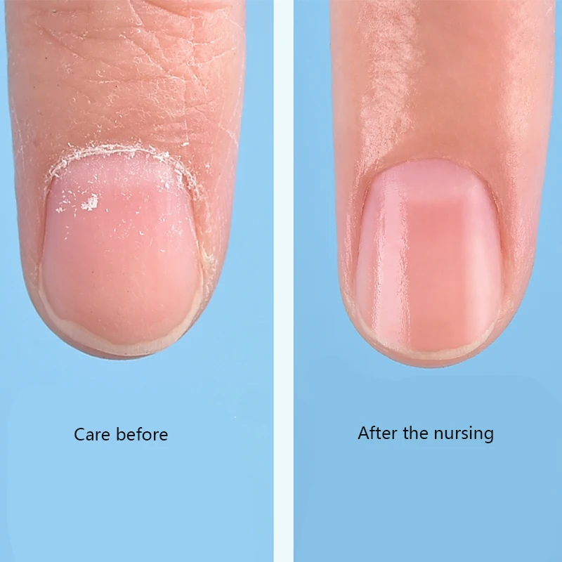 12 шт./компл. набор триммеров для маникюра и педикюра на пальцах ног новый модный