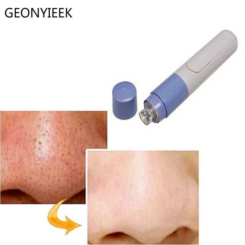 Электрический Очиститель пор для лица очиститель кожи лицо грязь сосать вакуум