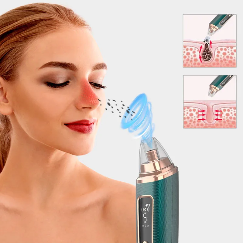 

NEW Electric Blackhead Remover Suction Pore Vacuum Cleaner Facial Blackhead Removal Tool Comedo Remover Blackhead Extractor