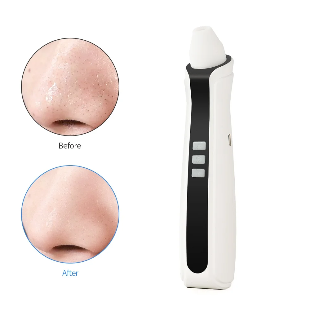 

USB Rechargeable Visual Blackhead Remover Facial Pores Black Head Cleaner Vacuum Suction 5 Mega-Pixel WIFI Microscope Camera