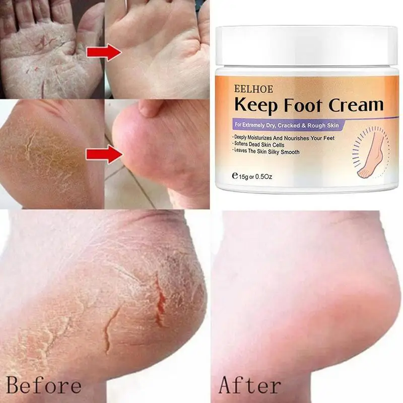

50g Chapped Hands And Feet Cream For Women Moisturizing Cream Skin Care Whitening Anti-Aging Skin A5U3