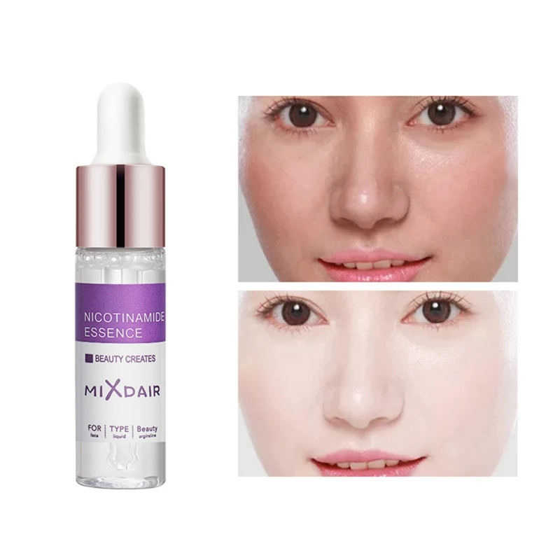 Nicotinamide стоковый раствор стойкий Увлажняющий Осветляющий пигмент тон кожи