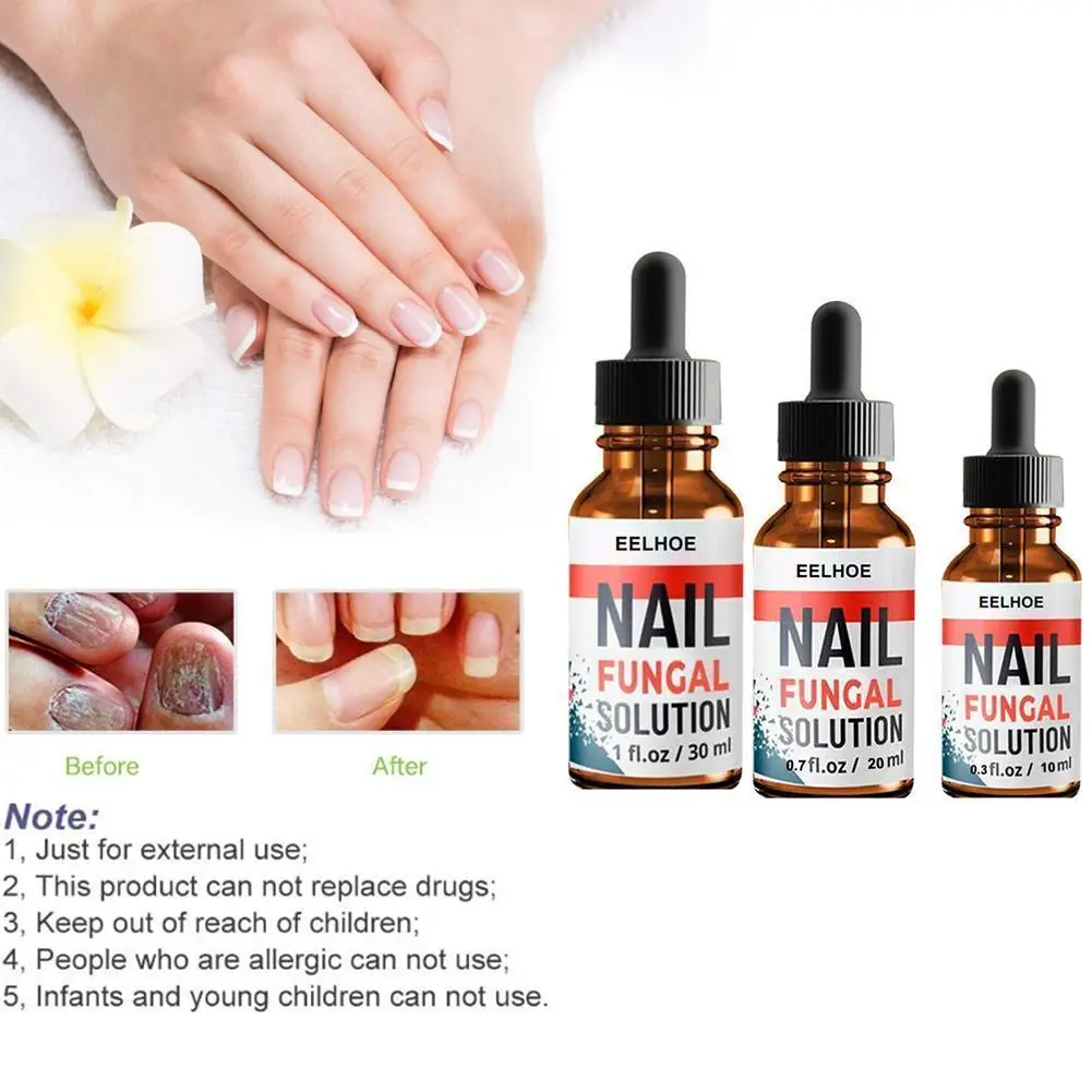 30ml Nail Repair Essence Onychomycosis Care Treatment Repair Damaged Nail Bed Removal Gel Paronychia Onychomycosis Infected Toen