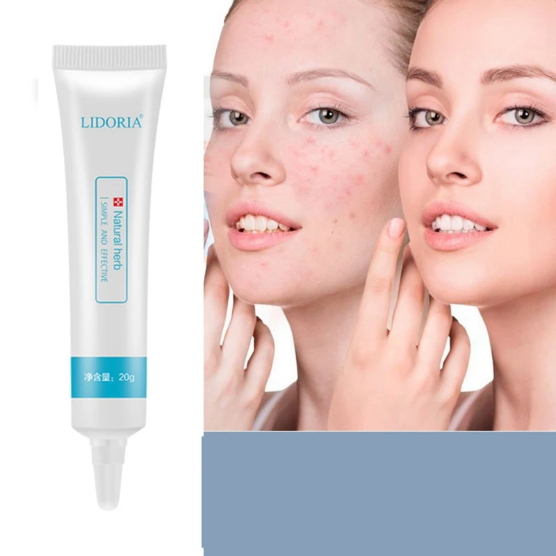 Acne Treatment Hyaluronic Acid Face Cream Acne Scar Remove Skin Care Shrink Pores Blemish Facial Spot Cream