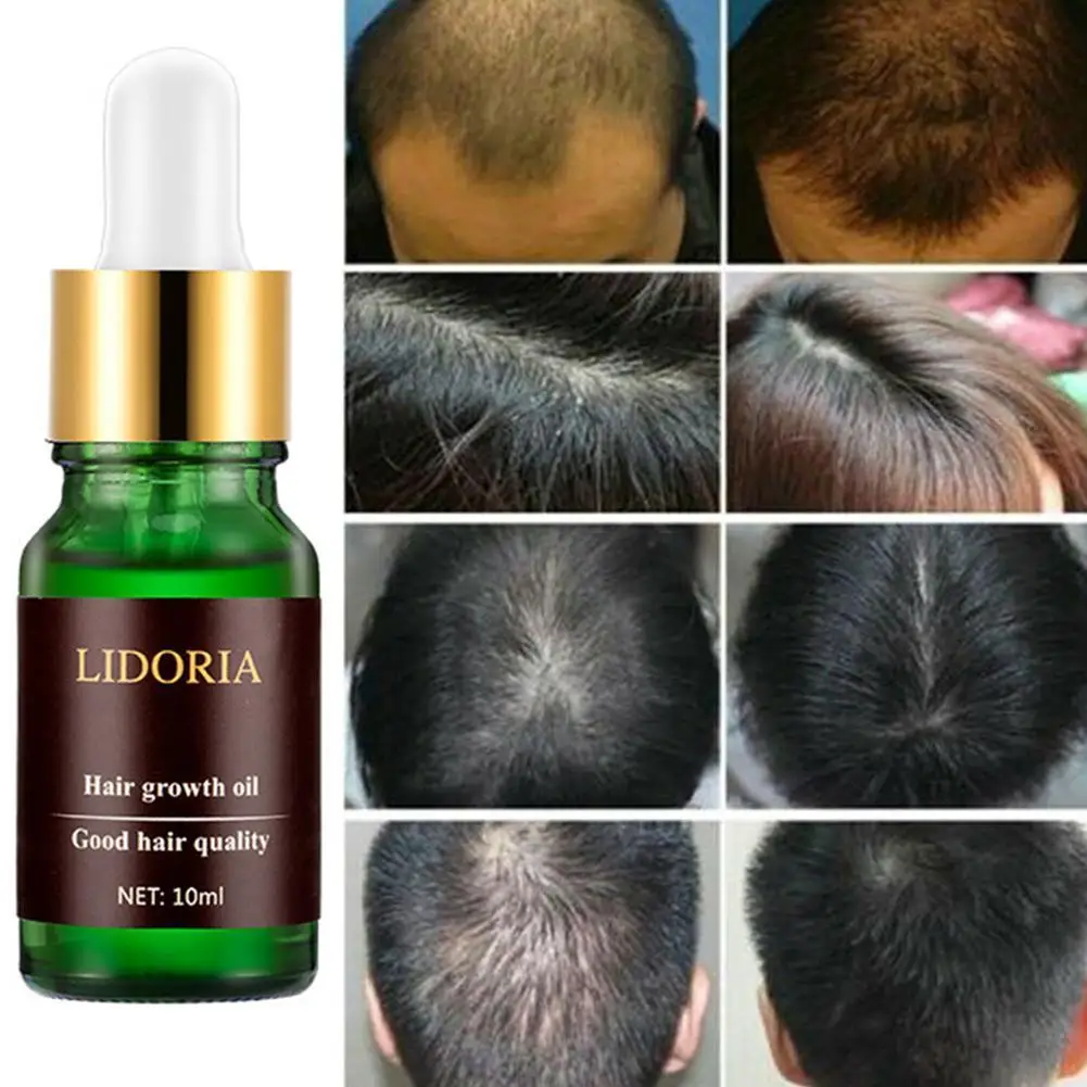 

Natural Extract Oil Regrow 7 Day Ginger Germinal Hair Growth Serum Hairdressing Oil L8U7