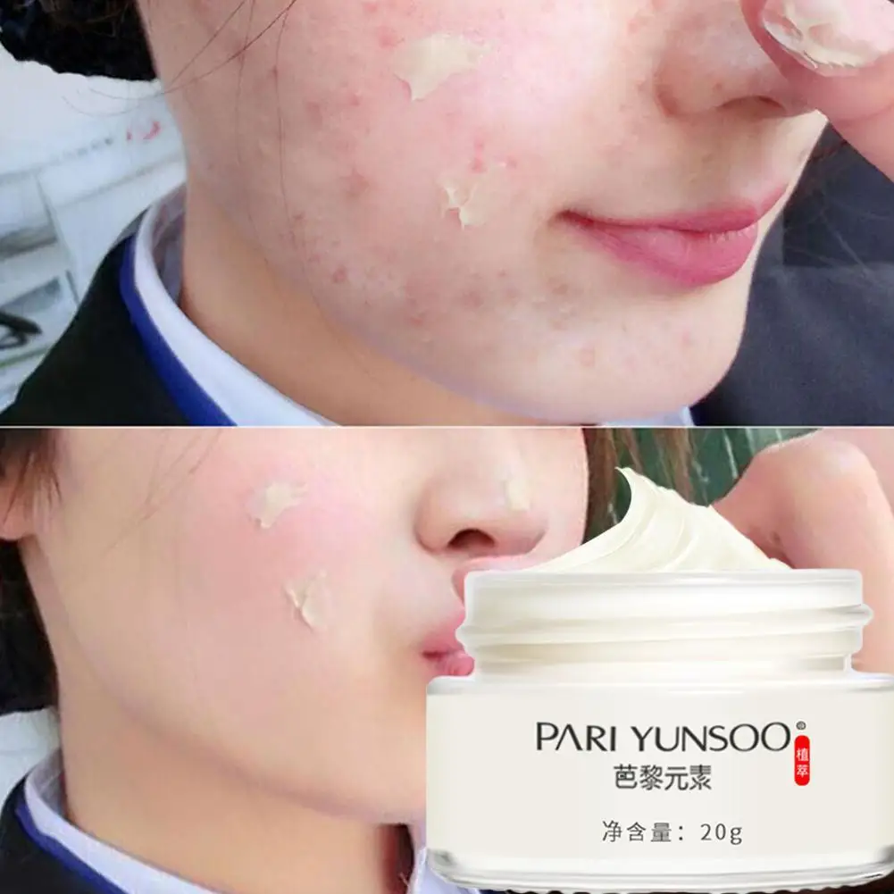 Ginseng Acne Treatment Cream Anti Acne Pimples Spot Herbal Remove Blackhead Skin Care Removal Whitening Cream Cream Scar Na U9E6