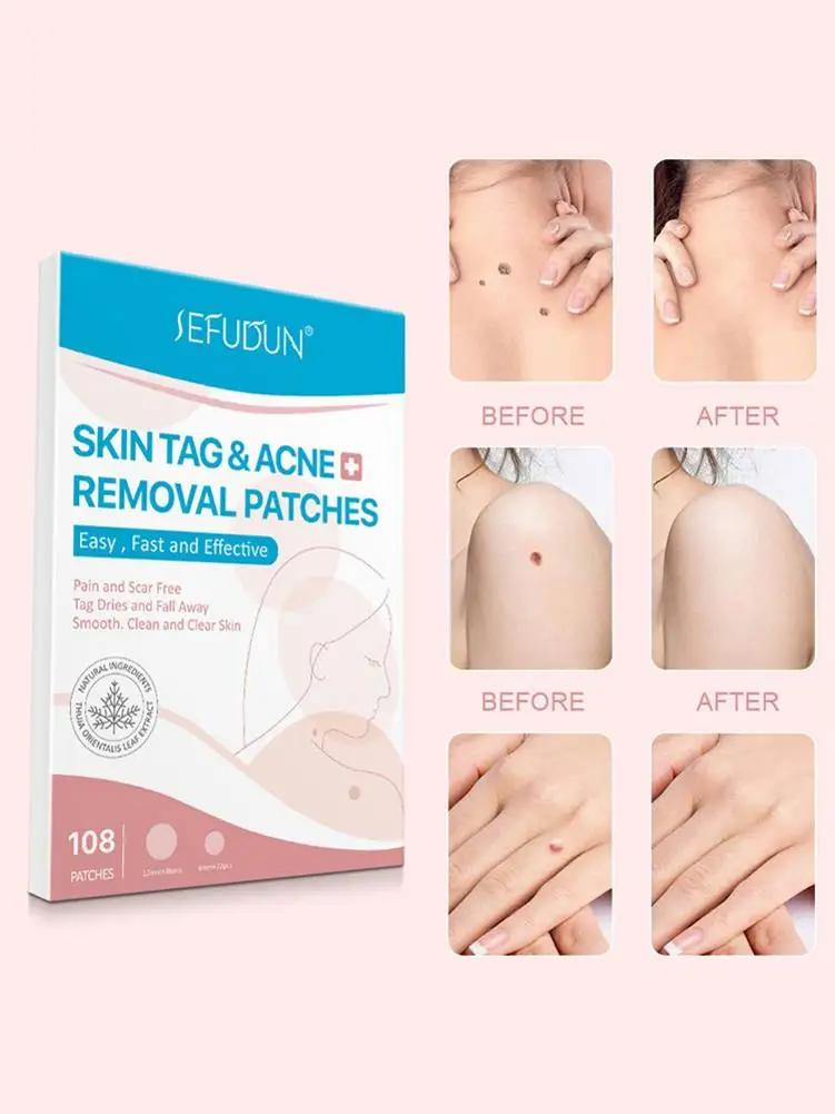

108PCS Skin Tag Remover Pimple Master Patch Treatment Invisible Acne Stickers Patch Skin Acne Concealer Tags Makeup Tools