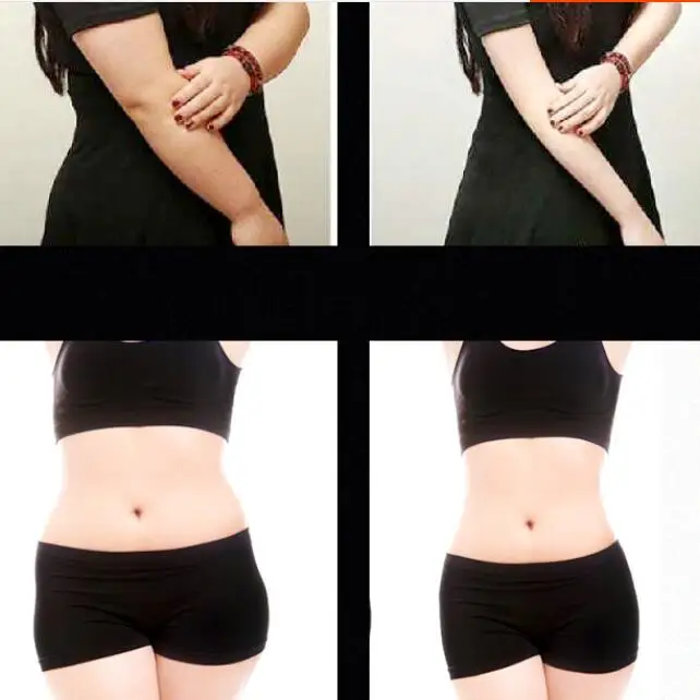 Германия 360 жировое вещество холодная замораживание формирование тела машина