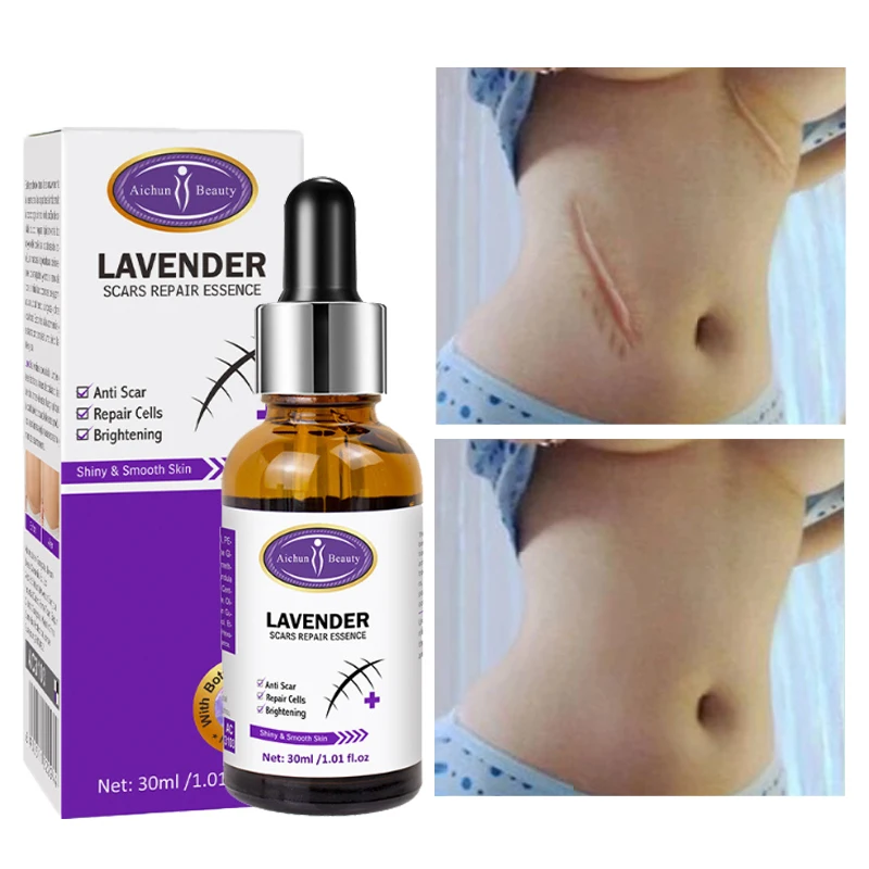 

Remove Scar Serum Improve Scars Trauma Surgery Wounds And Burns Repair Acne Marks Provide Nourishment The Skin Body Skin Care