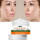 Крем для удаления акне VOVA, успокаивающий, увлажняющий, отбеливающий