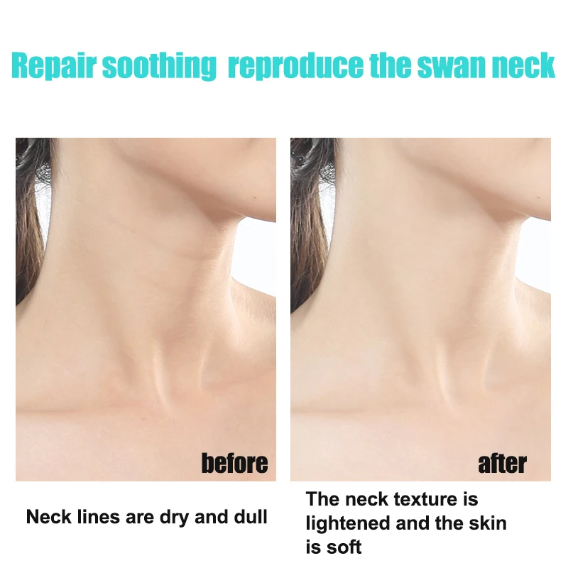 Укрепляющий крем для шеи с двойным роликом V-type уменьшения морщин и тонких линий