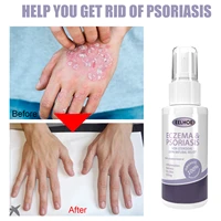 herbal antibacterial spray anti fungal itch remove psoriasis dermatitis eczema serum treatment rash urticaria desquamation care