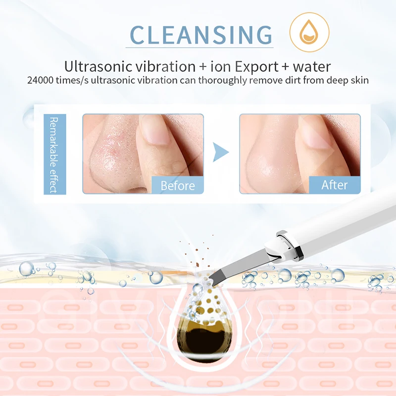 

Professional Skin Scrubber Face Spatula Deep Face Pore Cleaning Machine Blackhead Acne Remover Ultrasonic Peeling Shovel Cleaner
