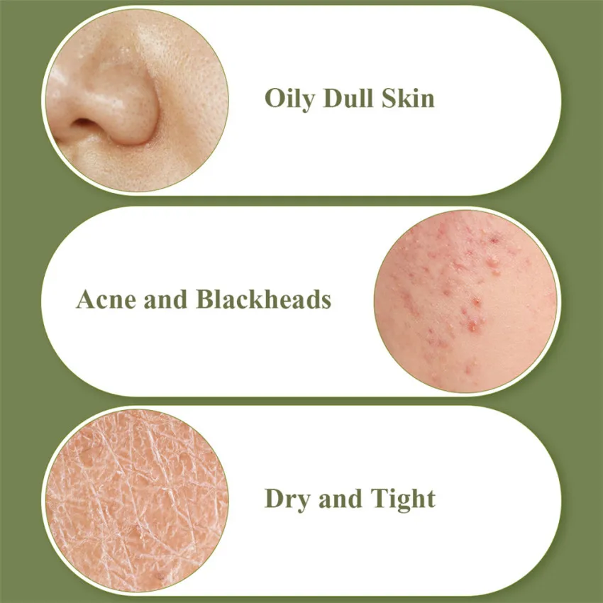 

BREYLEE Acne Clearing Oil Face Wash Soap Bar Essential Pore Deep Cleansing Treatment Remove Pimple Blackhead Body Dry Skin Care