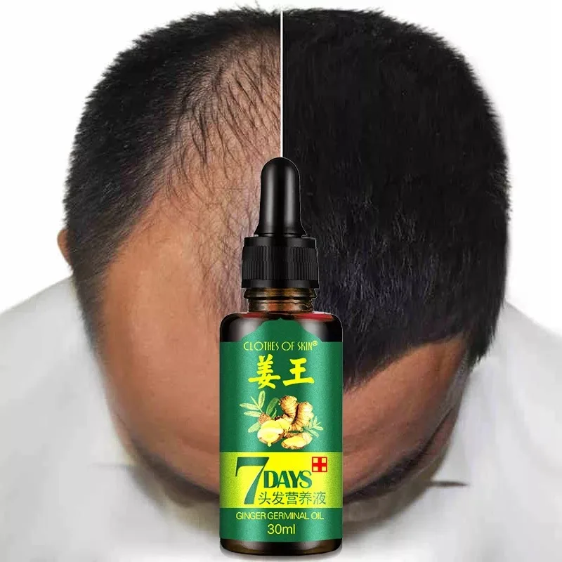 

7 Days Ginger Essence Hairdressing Hairs Mask Hair Essential Oil Hair Care Oil Essential Oil Dry and Damaged Hairs Nutrition