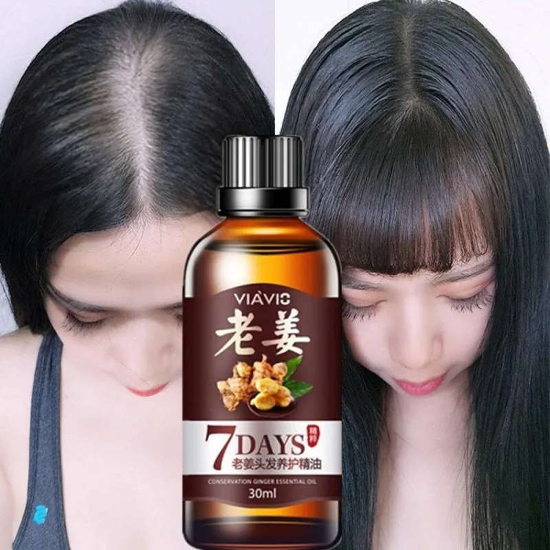 

Hot sale Fast Hair Growth Dense Regrowth Ginger Serum Oil Anti Loss Treatment Essence Bin Wild Hair Growth Tools Hair Care 30ml