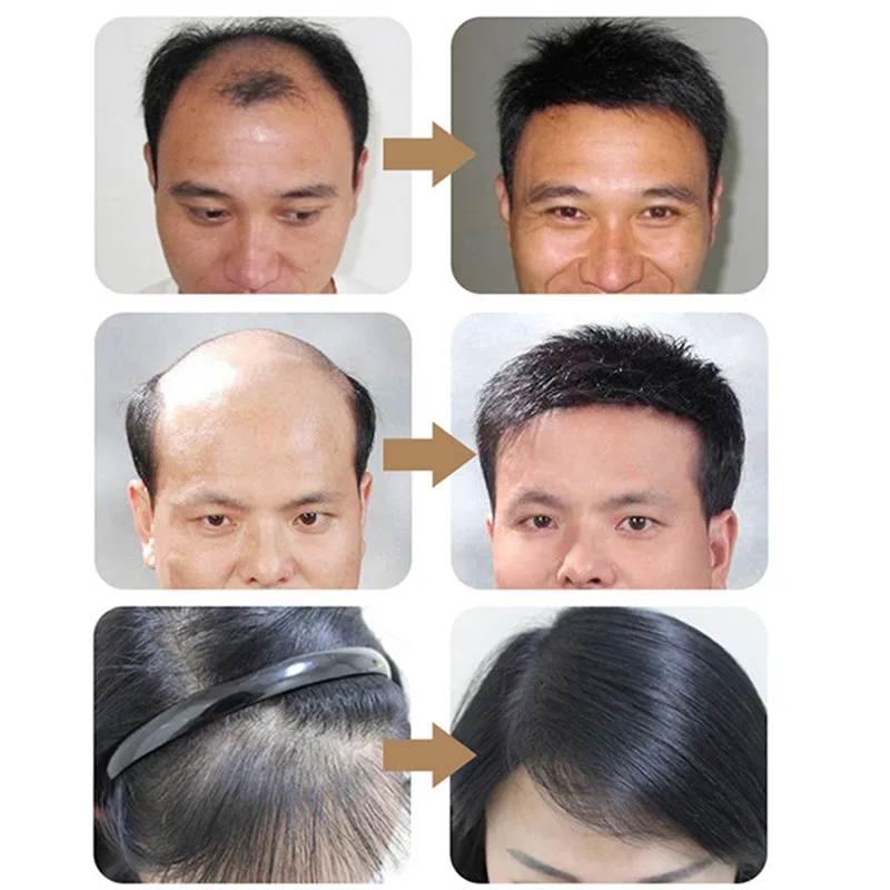 Питательное средство для ухода за волосами эфирное масло против выпадения волос