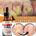 Эссенция для быстрого восстановления ногтей от грибков, сыворотка для ухода за ногтями, удаление грибка на ногтях, гель для лечения паронихии и онихомикоза TSLM1