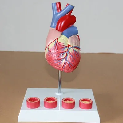 1:1 Human heart anatomical model thrombus Medical teaching model free shipping