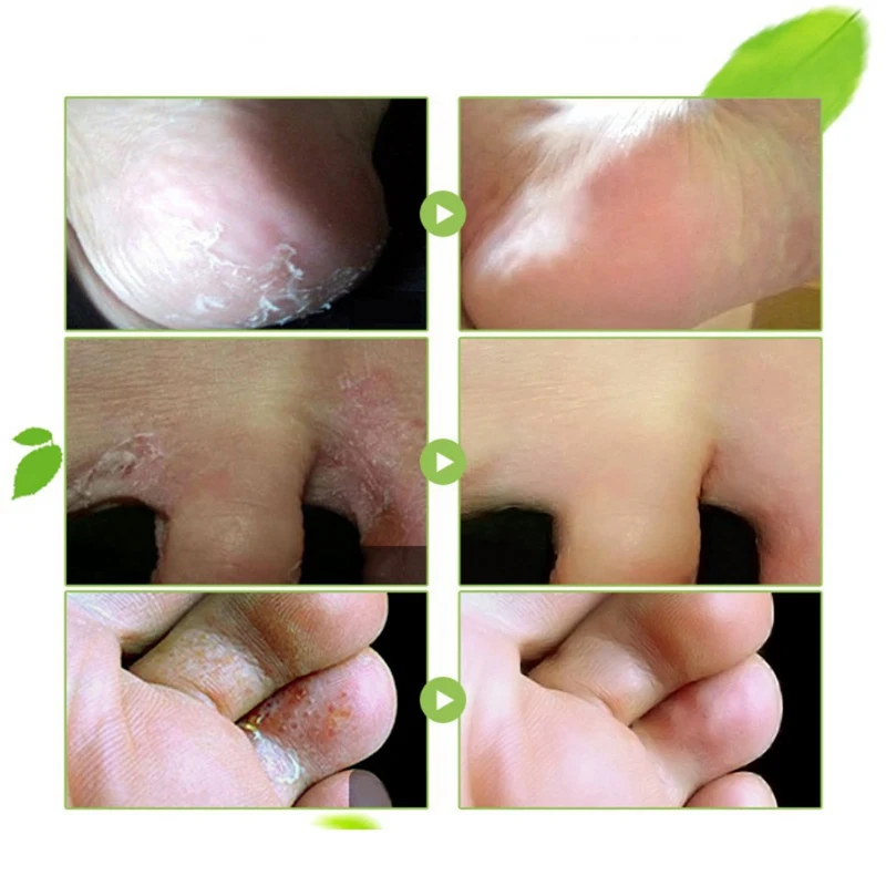 Крем для рук питательная эссенция увлажняющий крем кожи анти сушка сыворотка и