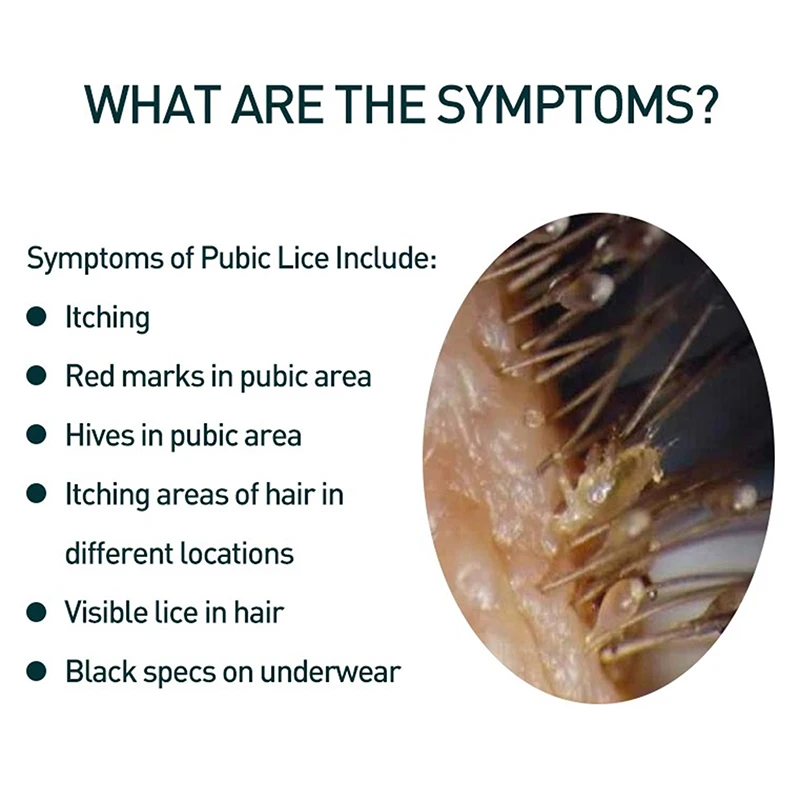 

1Pcs Herbal Scabies Cream Pubic Body Lice Mite Underarm Intimate Skin Care