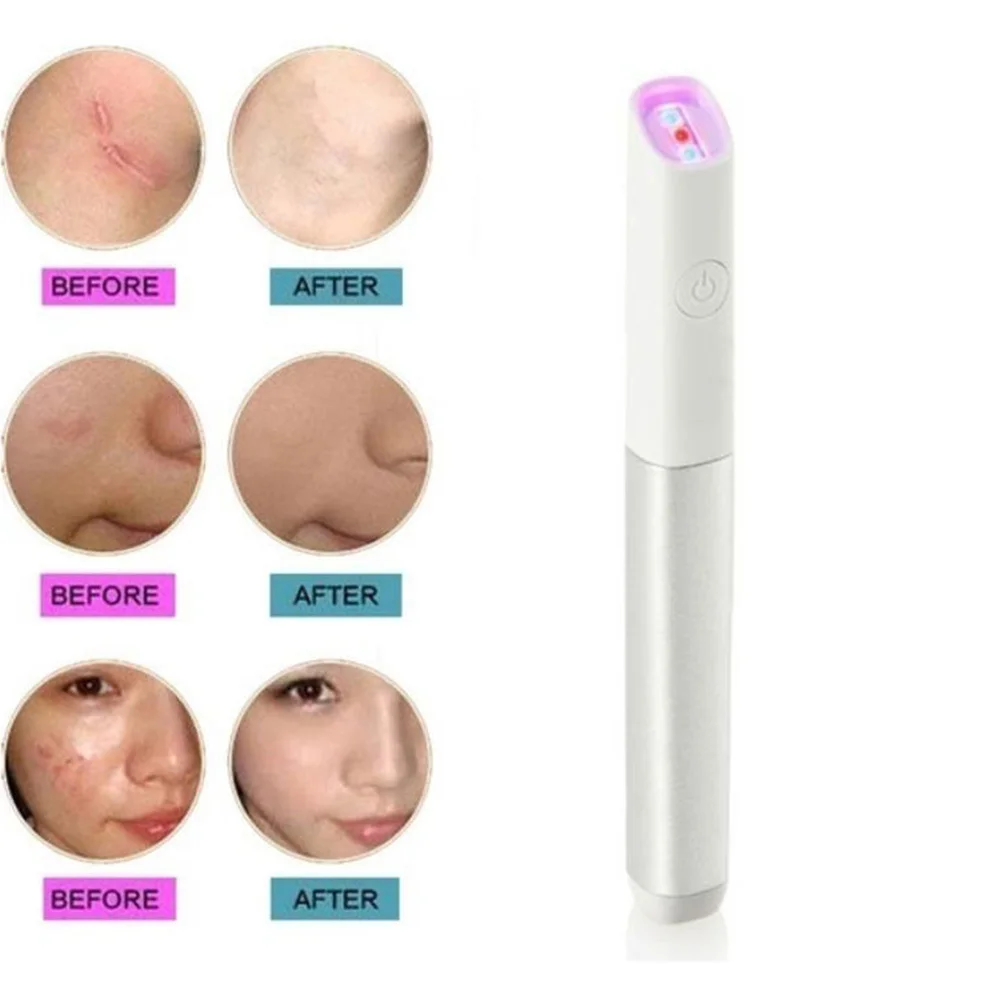 

Acne Scar Removal Pen Blue/Red Light Machine for Anti-Inflammation Scar Removal Treatment Skin Tightening