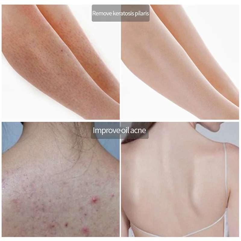 WXE никотинамид Body скраб-крем естественное тело обладает отшелушивающим эффектом