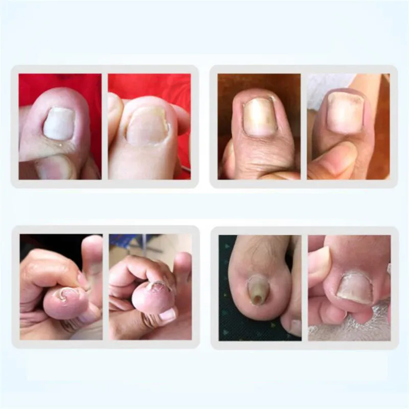 3 шт./1 шт. нержавеющая сталь | Красота и здоровье