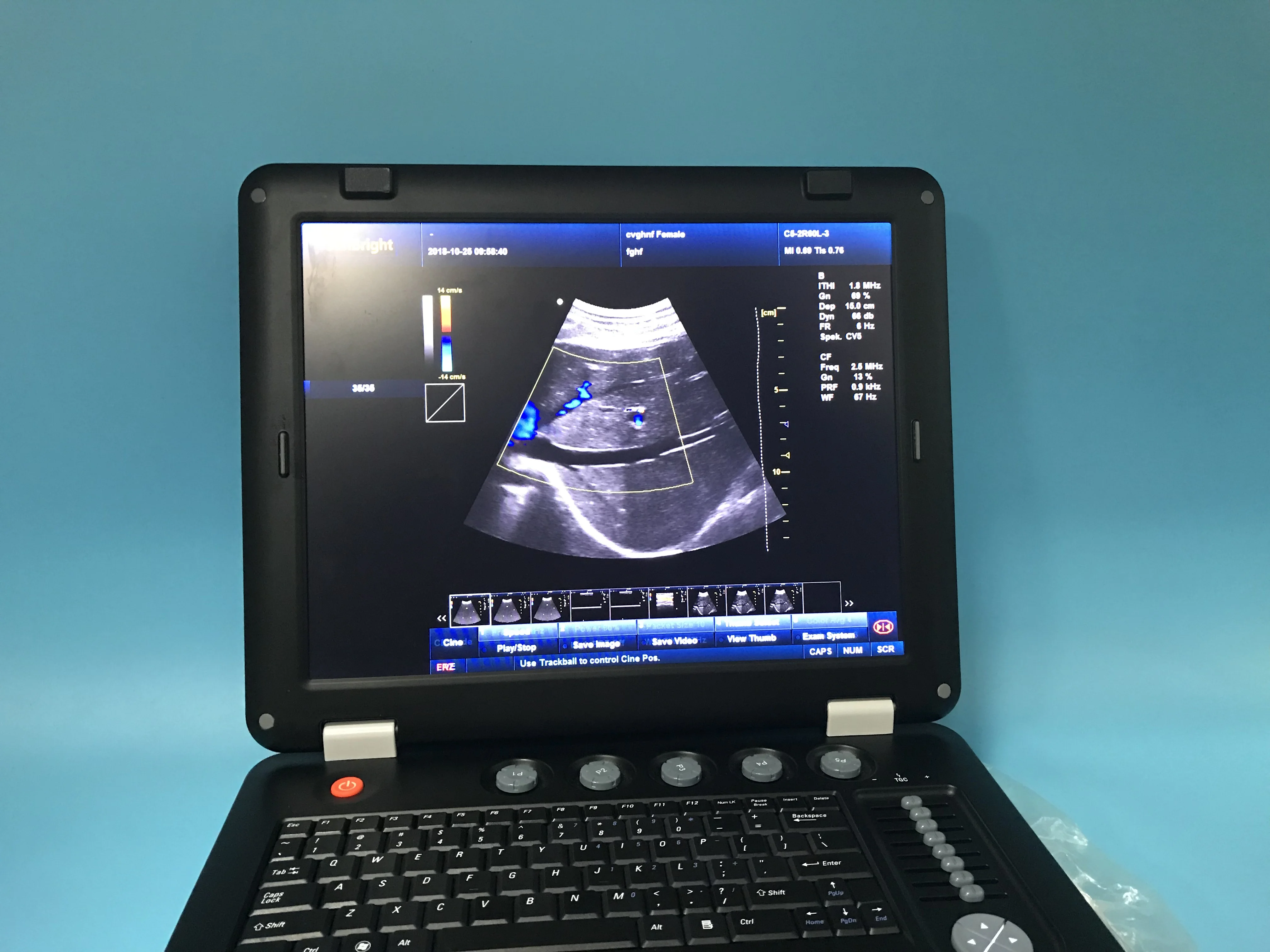 

Popular 2 probe ports portable ultrasound machine color 3D 4D medical doppler ultrasound